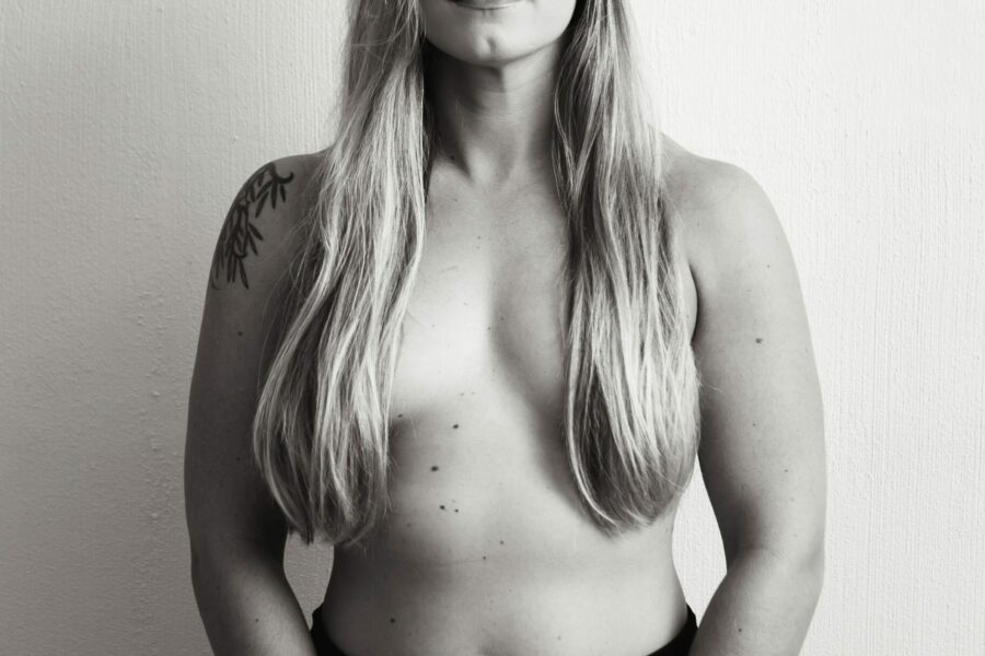 Explant surgery - Sascha Dua Breast Surgeon Explant surgery - Sascha Dua Breast Surgeon